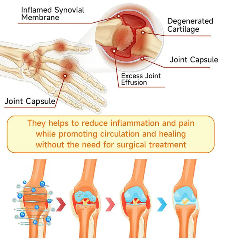 BEE VENOM LITHOSPERMUM Pain-Relief Bone Healing Cream - Image 12