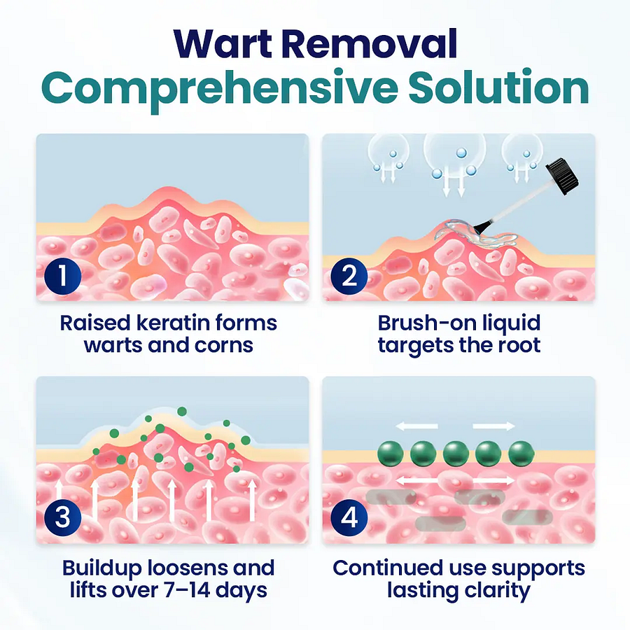 Wart Lift Wart Removal Liquid - Image 2