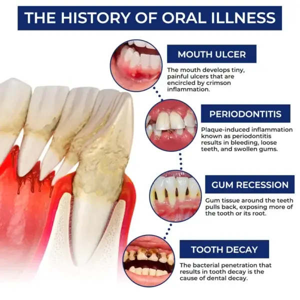 BeeTakt Bee Venom Dental Treatment Drops Mouthwash - Image 10