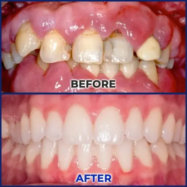 BeeTakt Bee Venom Dental Treatment Drops Mouthwash - Image 12