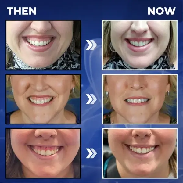 BeeTakt Bee Venom Dental Treatment Drops Mouthwash - Image 9