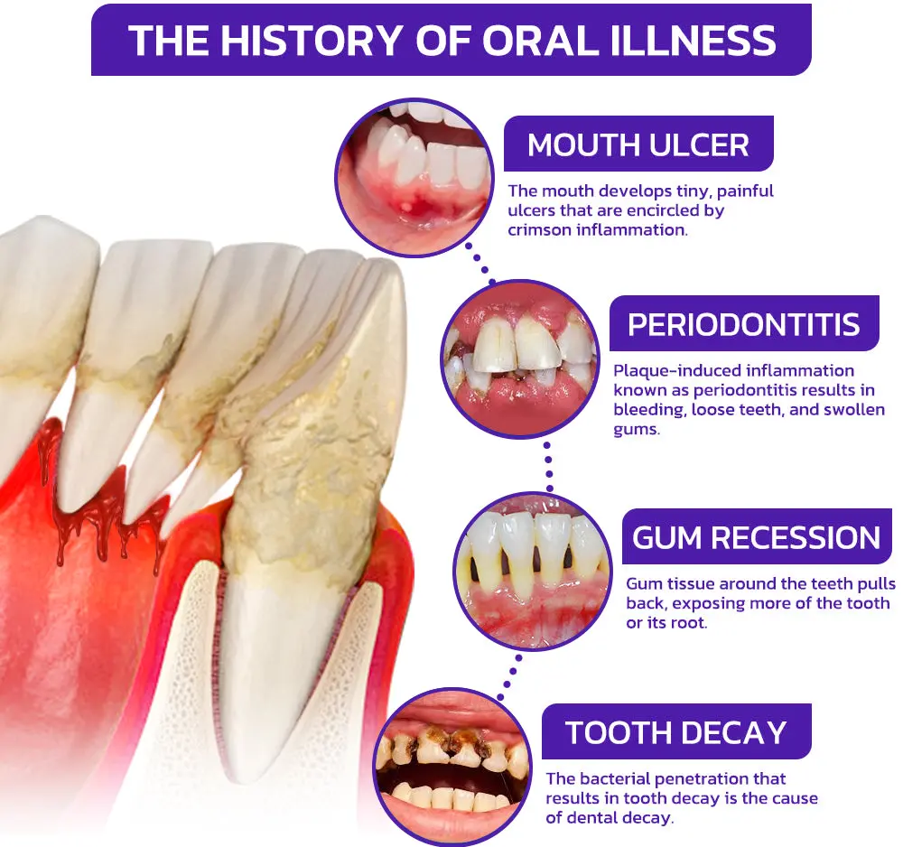 VioCore Bee Venom Dental Treatment Toothpaste - Image 13