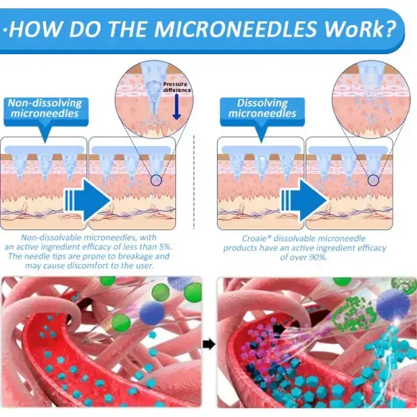 Nano Microneedle Patch - Image 12