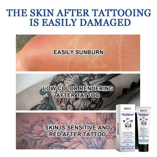 Tattoo Removal Cream - Fast Painless & Scar-Free Tattoo Erasure - Image 9