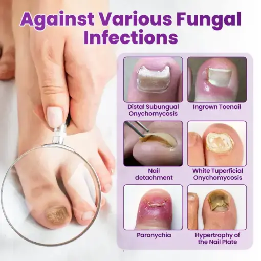 AeroFilm Foot Defense Mist - Image 5