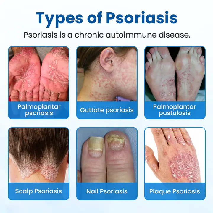 Magnesium Herbal Treatment Spray - Image 3