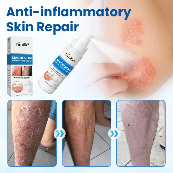 Magnesium Herbal Treatment Spray - Image 9