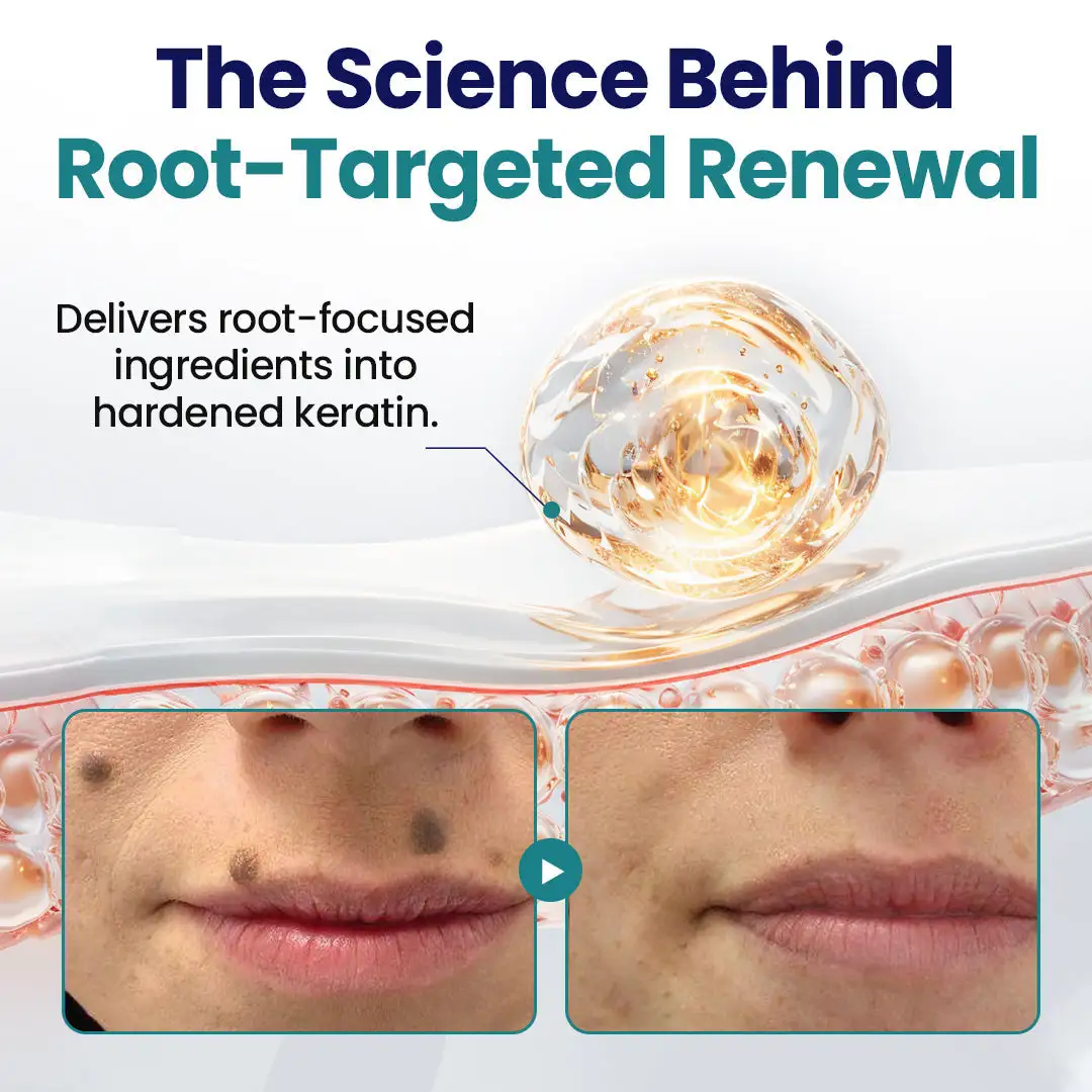 WartLift Corn Removal Liquid - Image 8