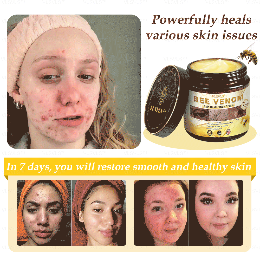 Winter Sale Bee Venom Skin Restoration Cream - Image 2
