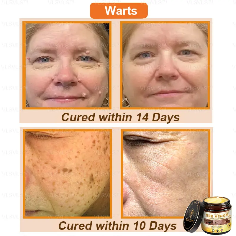 Winter Sale Bee Venom Skin Restoration Cream - Image 4