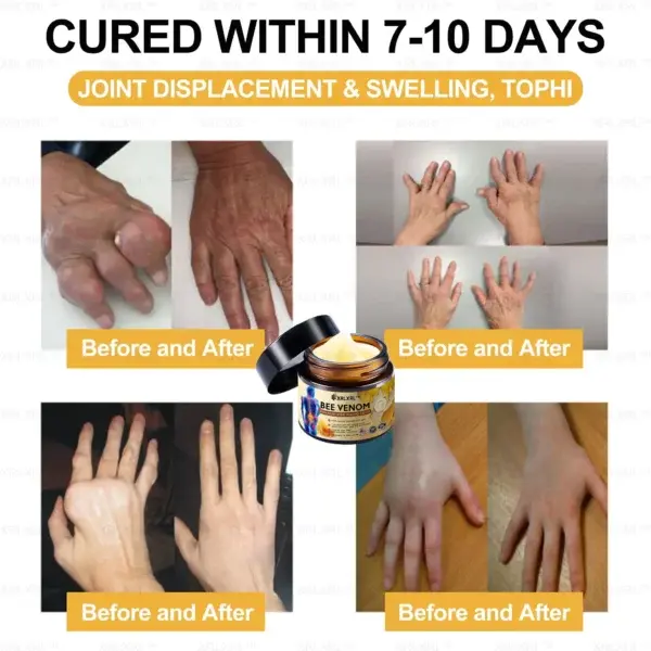 Bee Venom Arthritis Therapy Cream - Image 5