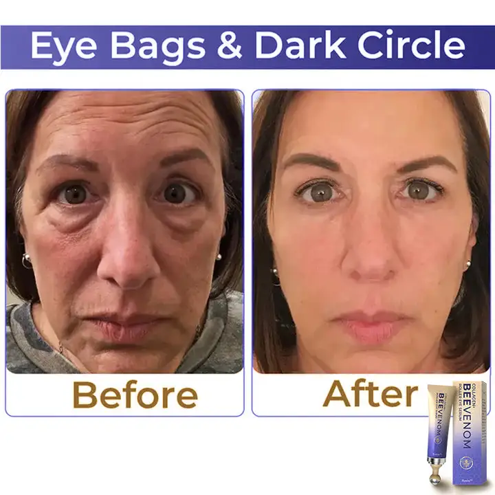 Collagen+ Bee Venom Roller Eye Cream - Image 2