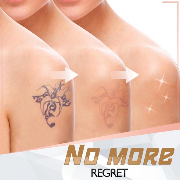 PainFree Tattoo Removal Cream - Image 4