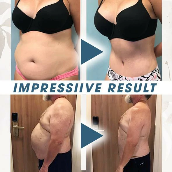 Magnetic Slimming Ear Patch 600pcs - Image 7