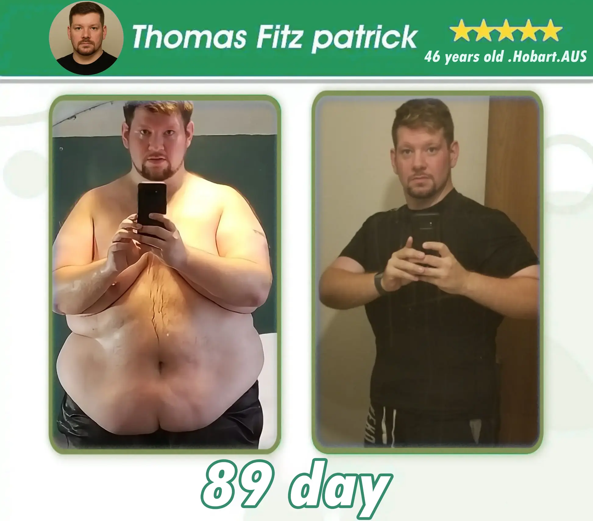 ๐๐๐๐ฅ๐ญ๐ก ๐๐ฅ๐ญ๐ซ๐ ๐๐จ๐ง๐๐๐ง๐ญ๐ซ๐๐ญ๐๐ ๐๐ฌ๐ฌ๐๐ง๐๐ ๐๐ข๐ช๐ฎ๐ข๐ ๐๐๐๐๐ฌ - Image 4