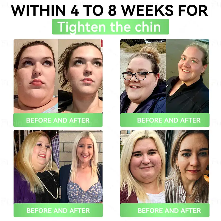 ๐ฎ๐๐ ๐ช๐๐๐๐๐๐ ๐๐๐
๐บ๐๐๐ ๐บ๐๐๐๐๐๐ ๐ท๐๐๐๐๐ - Image 5