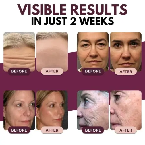 Calcium Balm - Image 2