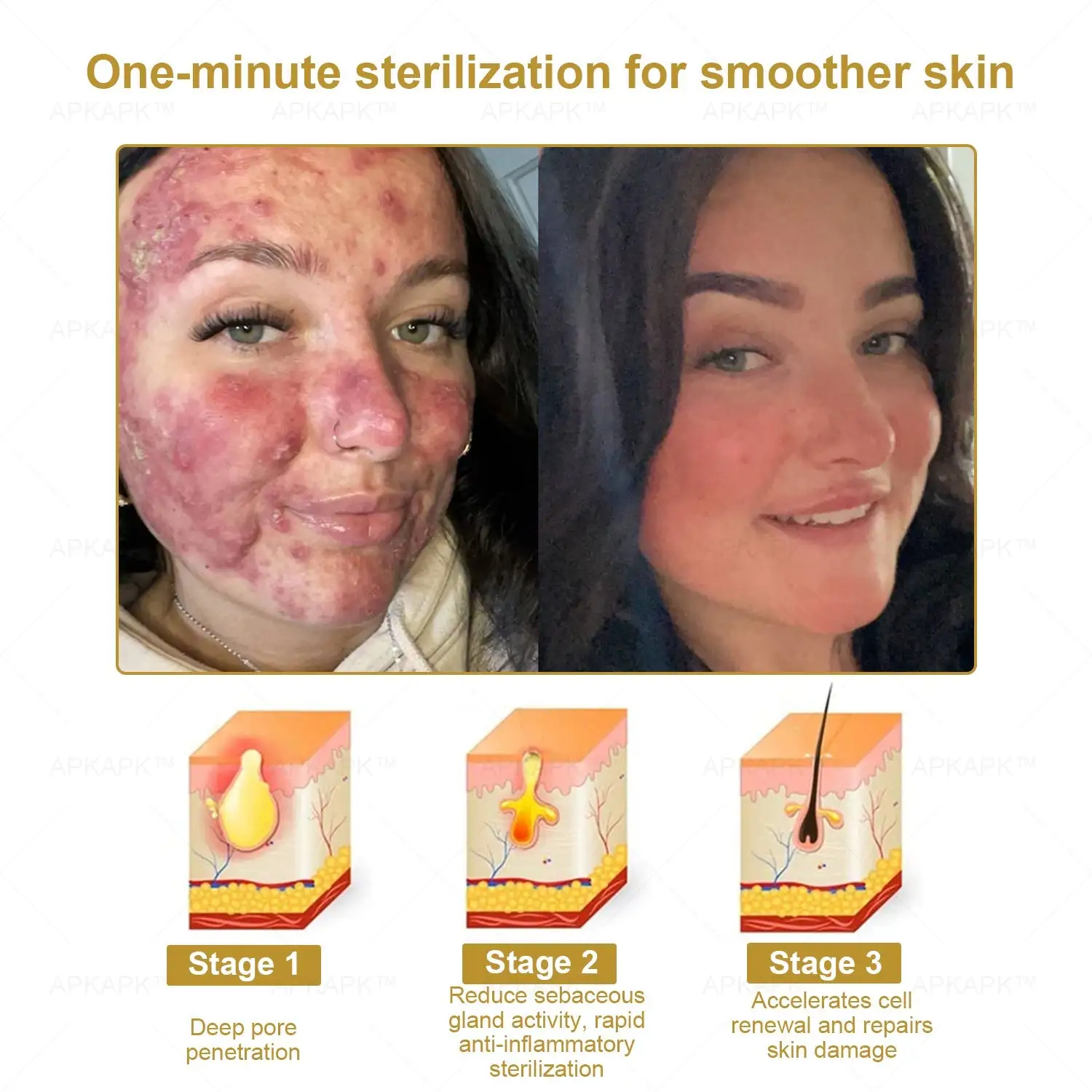 Effective All-in-One Skin Treatment Cream - Image 4