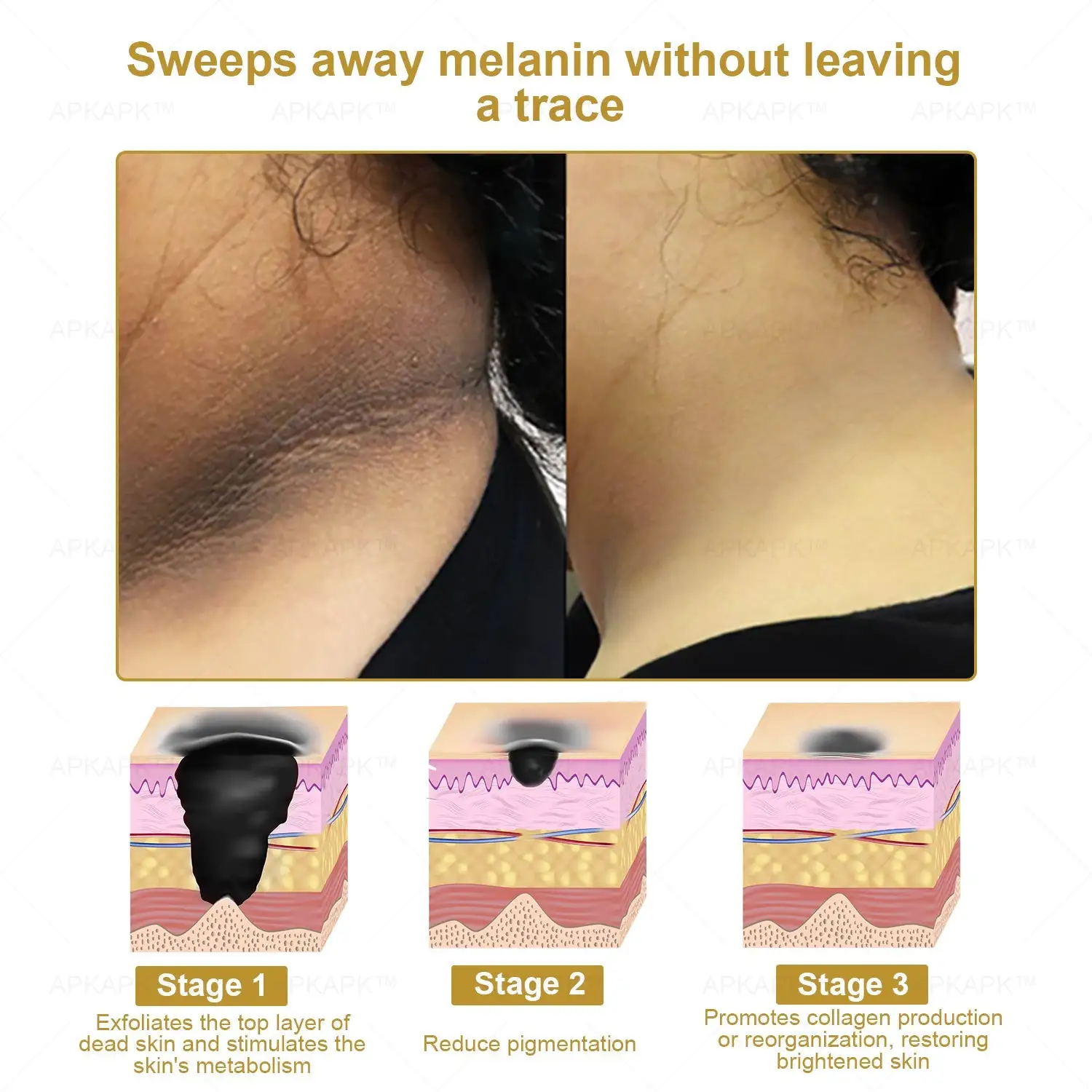 Effective All-in-One Skin Treatment Cream - Image 6