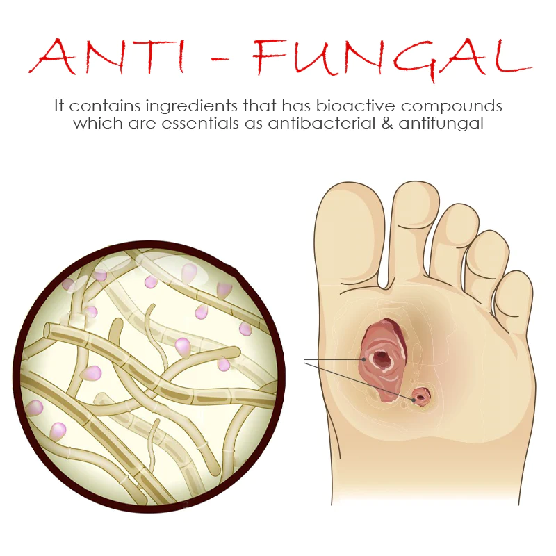 ATTDX BedSores FastHealing TreatmentCream - Image 4