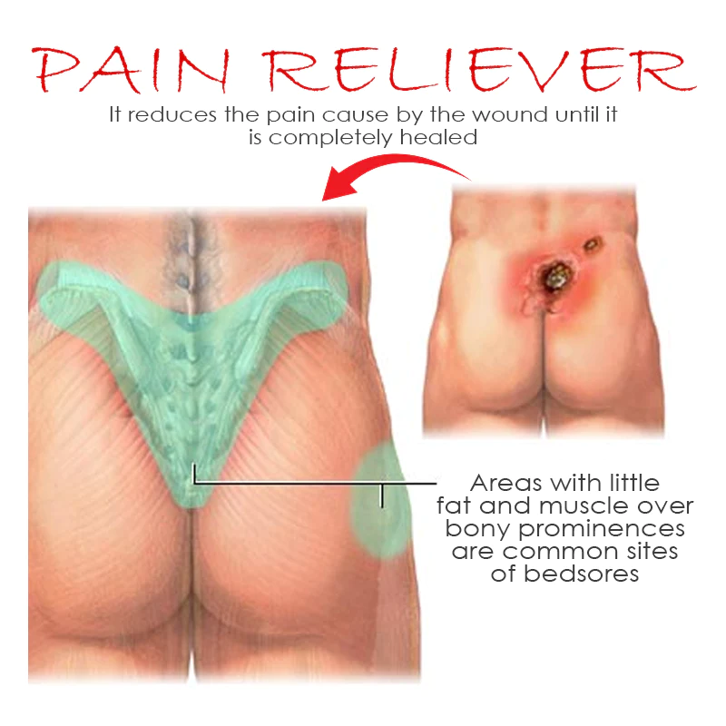 ATTDX BedSores FastHealing TreatmentCream - Image 3