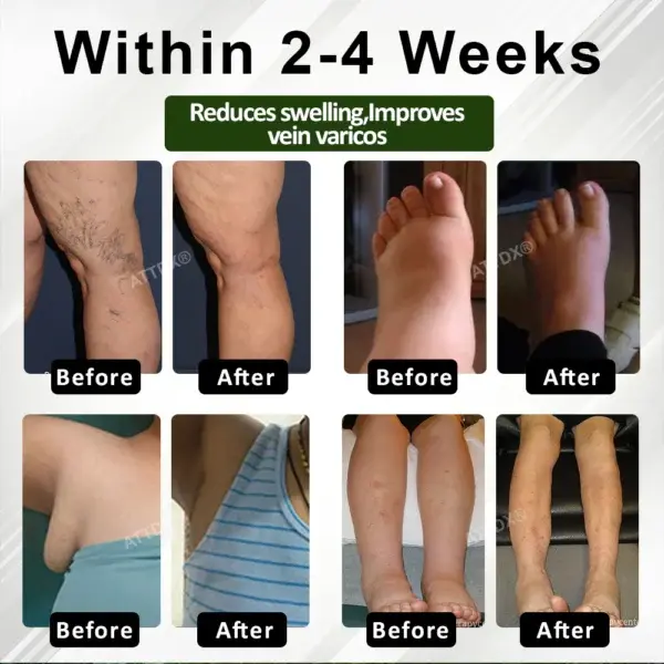 CircuHerb Edema Soothing & Healing Balm - Image 12