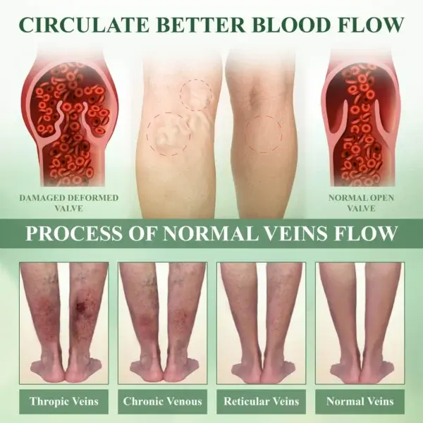 CircuHerb Edema Soothing & Healing Balm - Image 9