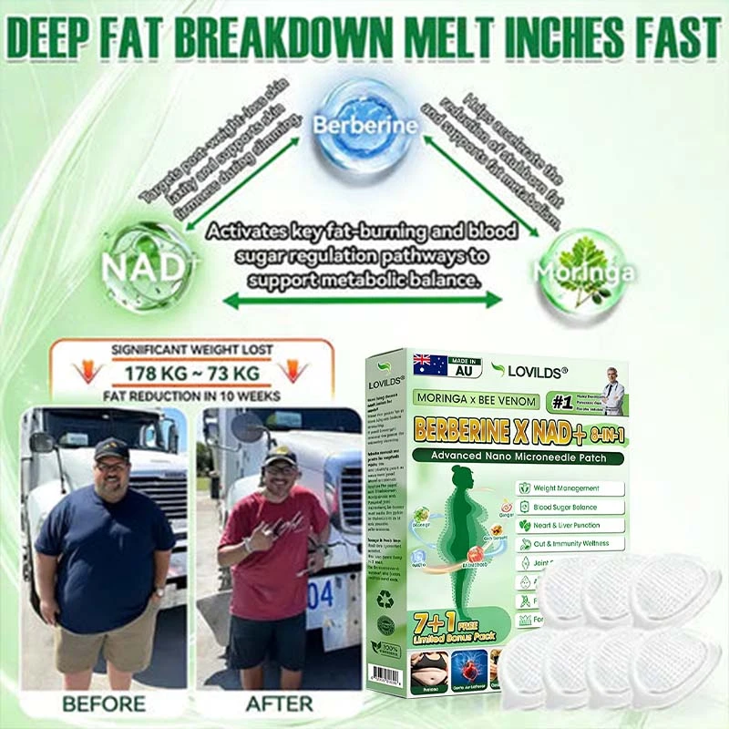 ๐๐จ๐ซ๐ข๐ง๐ ๐ ยท ๐๐๐ ๐ฏ๐๐ง๐จ๐ฆ ยท ๐๐๐ซ๐๐๐ซ๐ข๐ง๐ ร ๐๐๐+ ๐-๐ข๐ง-๐ ๐๐๐ฏ๐๐ง๐๐๐ ๐๐๐ง๐จ ๐๐ข๐๐ซ๐จ๐ง๐๐๐๐ฅ๐ ๐๐๐ญ๐๐ก - Image 8