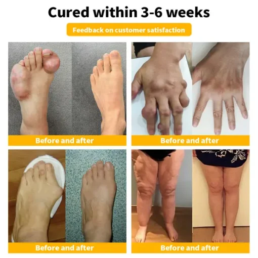 Bee Venom & Turmeric Arthritis Therapy Cream - Image 9