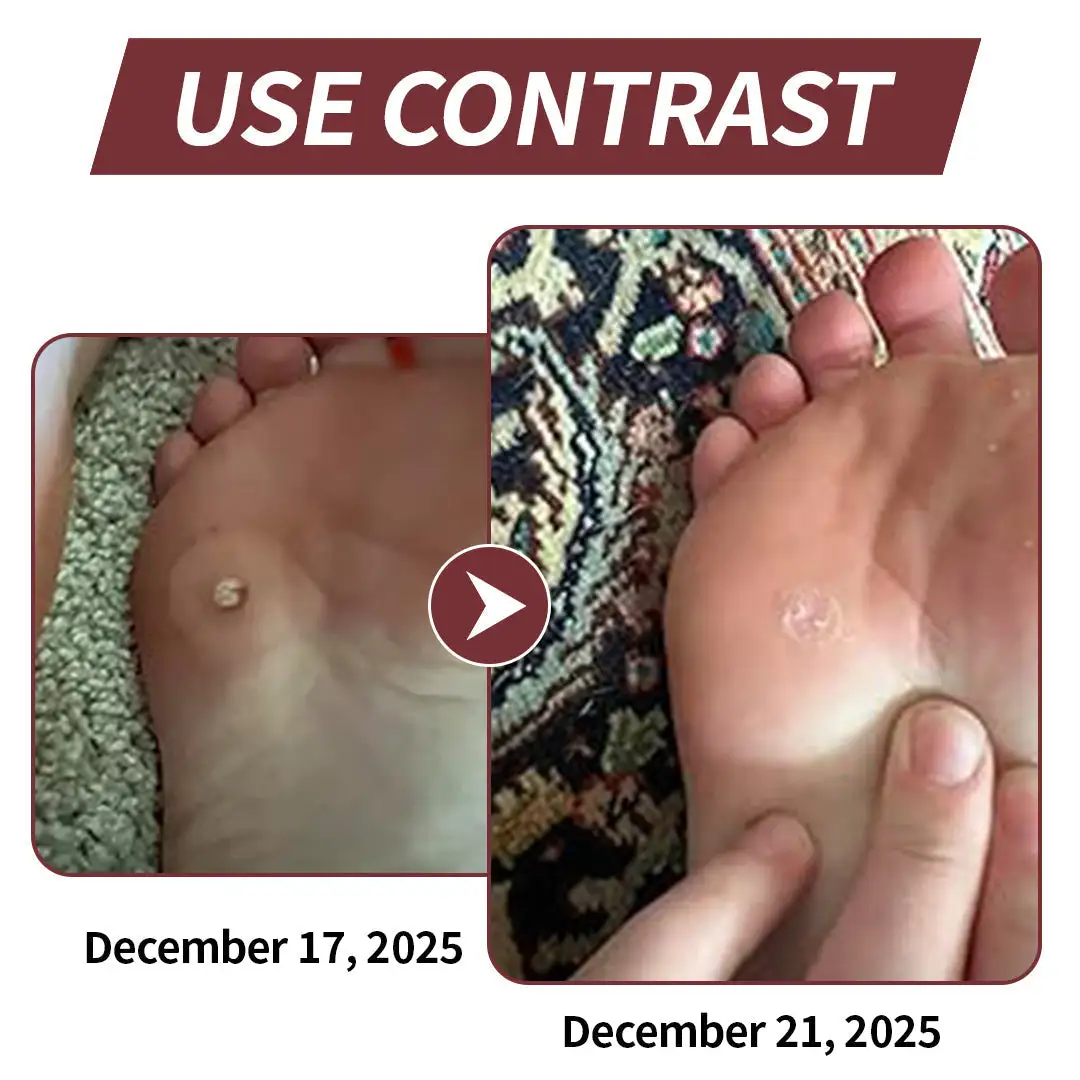 KeraErase Dual-Action Renewal Cream - Image 2