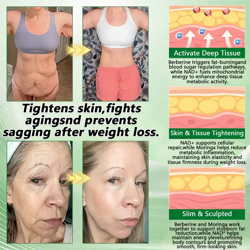 ๐๐ฒ๐ฟ๐ฏ๐ฒ๐ฟ๐ถ๐ป๐ฒ ๐๐-๐ข๐ง-๐ ๐ก๐ฎ๐ป๐ผ ๐ ๐ถ๐ฐ๐ฟ๐ผ๐ป๐ฒ๐ฒ๐ฑ๐น๐ฒ ๐ฃ๐ฎ๐๐ฐ๐ต - Image 8