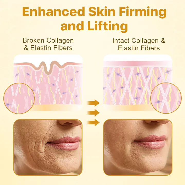 𝐁𝐨𝐭𝐨𝐱𝐋𝐮𝐱 𝐁𝐞𝐞 𝐕𝐞𝐧𝐨𝐦 𝐋𝐢𝐟𝐭 𝐂𝐫𝐞𝐚𝐦 - Image 4