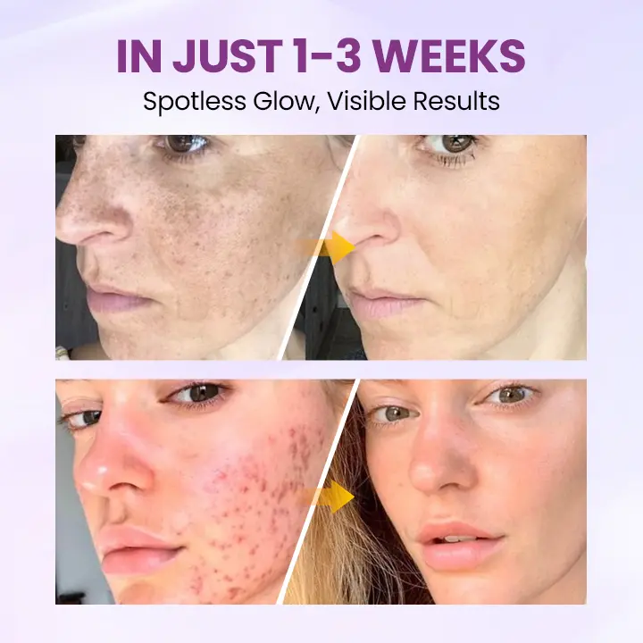 RadiantClear Blemish & Brightening Serum - Image 4