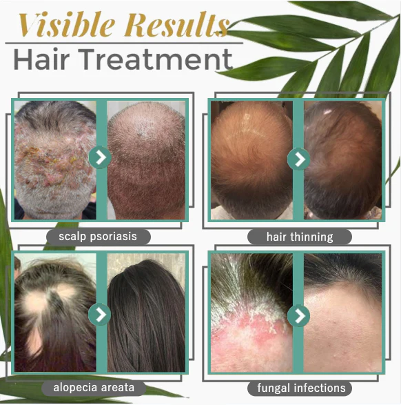 Fᴏlliᴄle-Bᴏᴏsting Hair Serum - Image 6