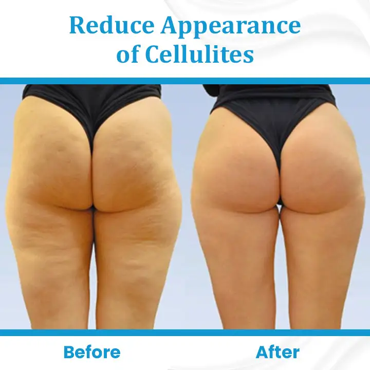 EternaLIFT Ultra Firming Skin Cream - Image 7