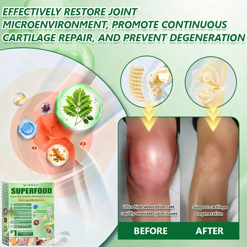 ๐๐ฎ๐ฉ๐๐ซ๐๐จ๐จ๐ ๐๐๐ง๐จ-๐๐๐๐๐ฅ๐ ๐๐๐ญ๐๐๐จ๐ฅ๐ข๐ฌ๐ฆ ๐๐๐ญ๐๐ก - Image 11