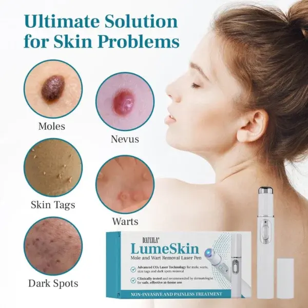 LumeSkin Mole and Wart Removal Laser Pen - Image 3