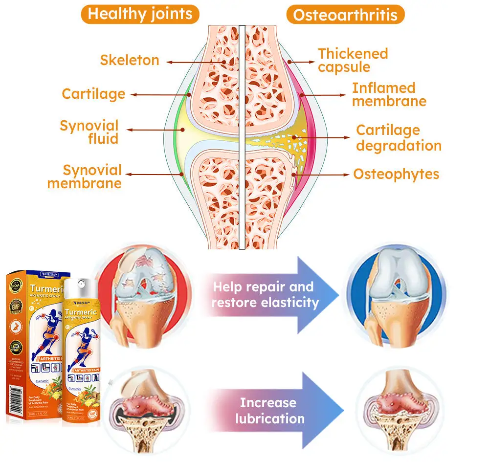 Turmeric Arthritis Spray - Image 3