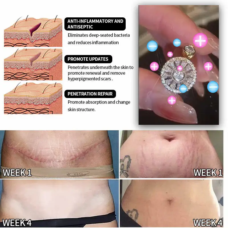 Lymphatic Magnetic Detox Spinning Ring - Image 5