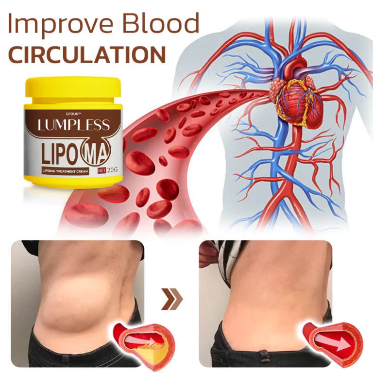 Lumpless Lipoma Treatment Cream - Image 5