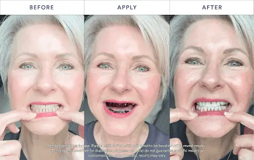 Purple Teeth Whitening Strips - Image 9