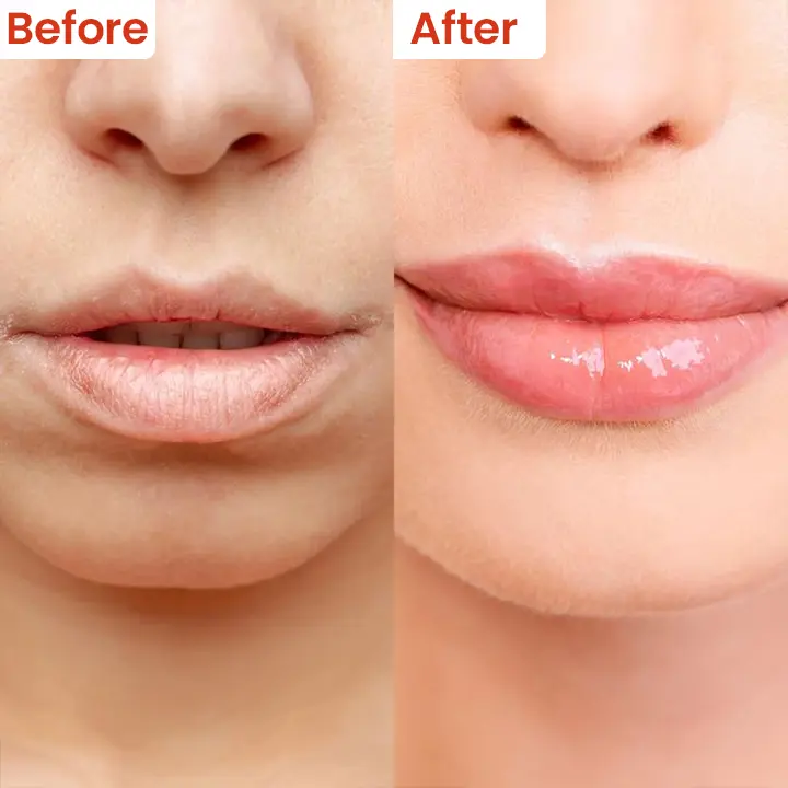 Cheilitis Cream - Image 11