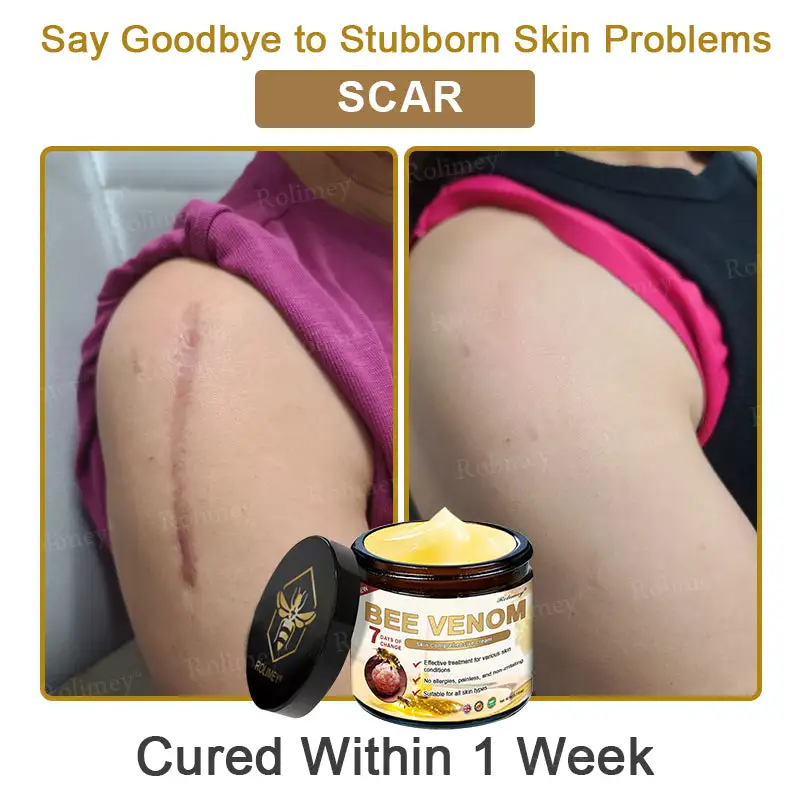 Bee Venom Skin Comprehensive Cream - Image 11