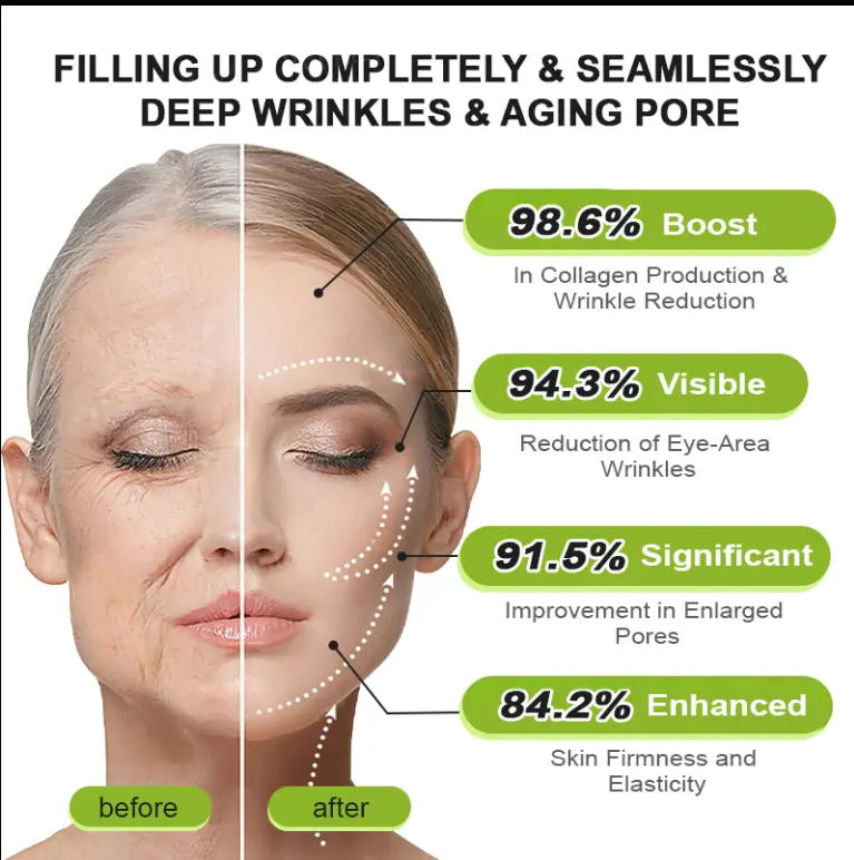 Botox Vitamin A Retinol Anti-Wrinkle Firming and Lifting Cream - Image 8