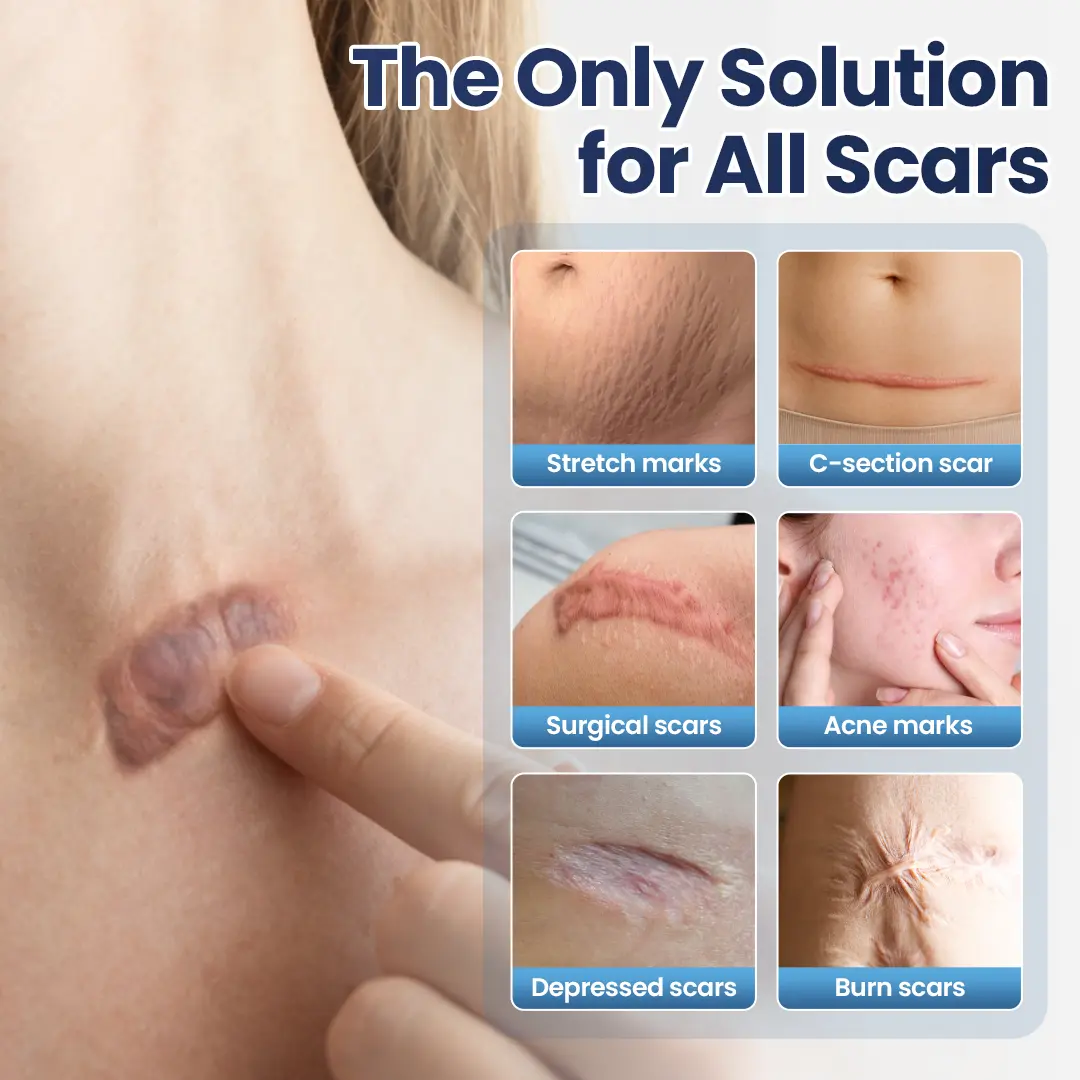 DermaFix Texture Repair Gel - Image 8