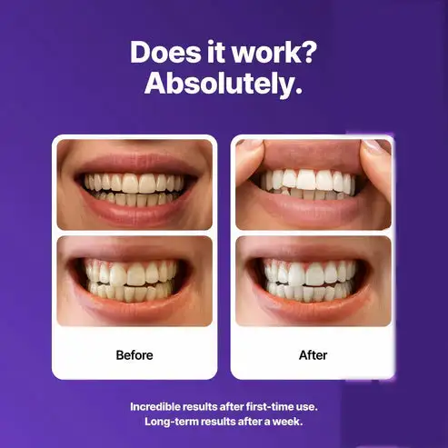 Nexisify Purple Teeth Whitening Strips - Image 3