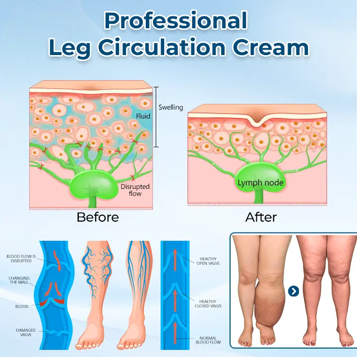 LymphoEase Magnesium PCA Roll-On Relief Cream - Image 3