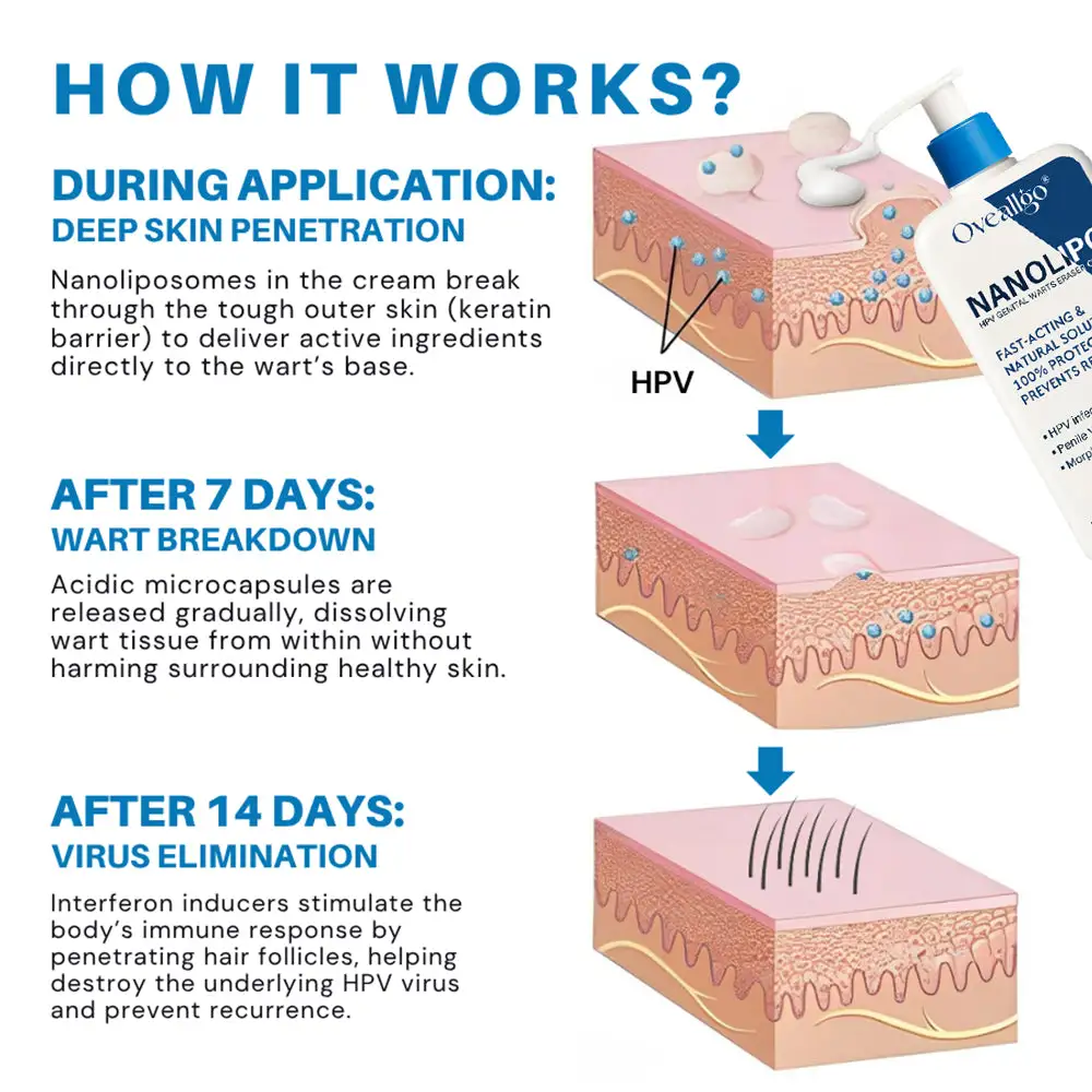 NanoLipo HPV Genital Warts Eraser Cream ProX - Image 4