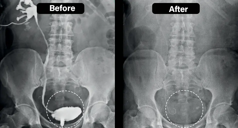 TitaniumMag Prostate Wellness Bracelet - Image 9