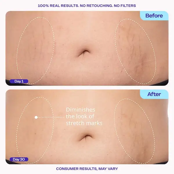 Tighten & Smooth Belly Cream - Image 2